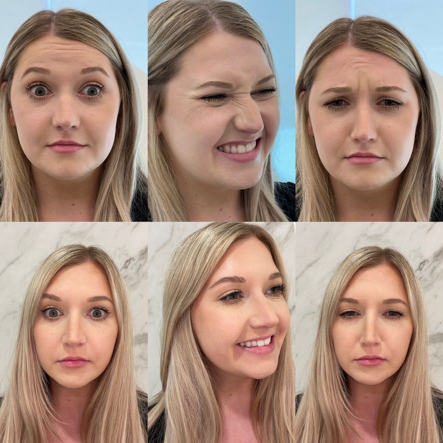 Botox Before & After