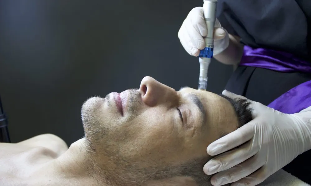 SkinPen Microneedling in Costa Mesa, CA - ICONIQUE MedSpa