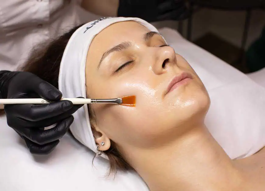 Chemical Peels Treatment by ICONIQUE Medical Aesthetics in Costa Mesa, CA